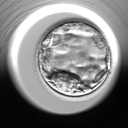 https://aditum.org/images/article/220119055507_7854468.jpeg