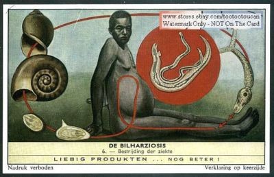 Картинки по запросу Schistosomiasis on stamps