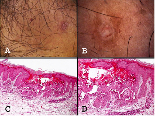 An external file that holds a picture, illustration, etc.
Object name is dr-12-2-8791-g001.jpg
