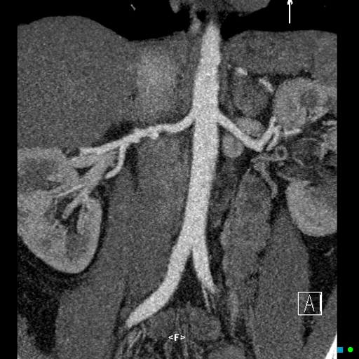 A close-up of an x-ray of a person's body
AI-generated content may be incorrect.
