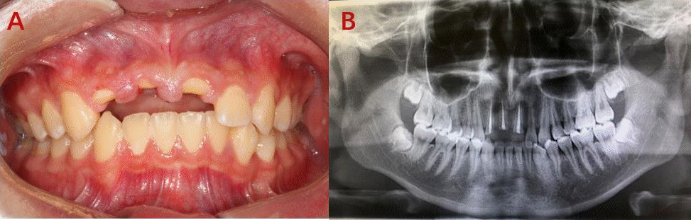 Fig1