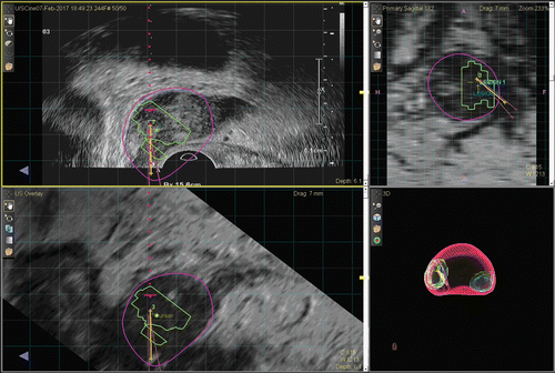 FIG. 2.